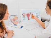 Los obstáculos que enfrentan las mujeres que no quieren ser madres y quieren ligarse las trompas en América Latina