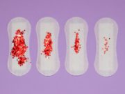 Por qué las mujeres son propensas a presentar deficiencias de hierro